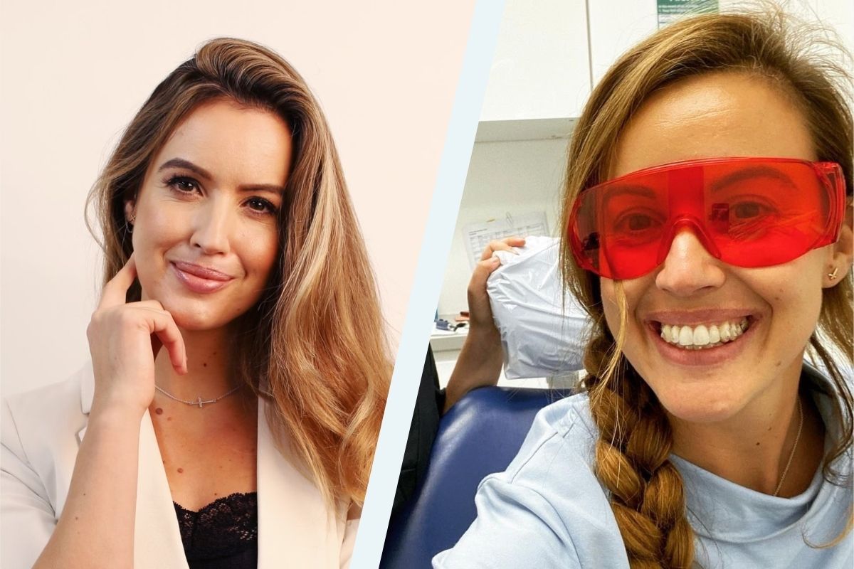 Clear Teeth Aligners Dental Art Implant Clinics